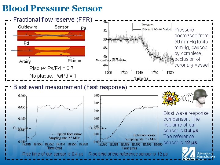 Blood Pressure Sensor Fractional flow reserve (FFR) Pressure decreased from 50 mm. Hg to