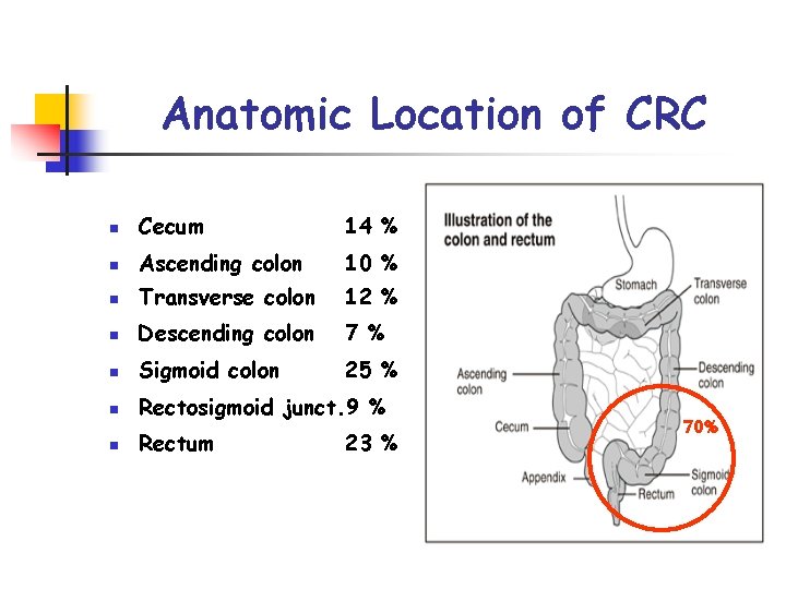 Anatomic Location of CRC n Cecum 14 % n Ascending colon 10 % n
