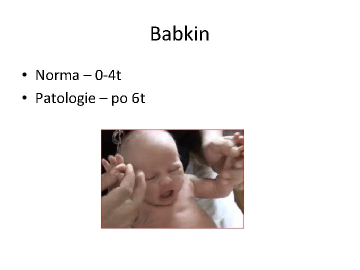 Babkin • Norma – 0 -4 t • Patologie – po 6 t 