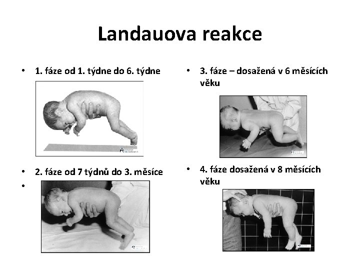 Landauova reakce • 1. fáze od 1. týdne do 6. týdne • 3. fáze