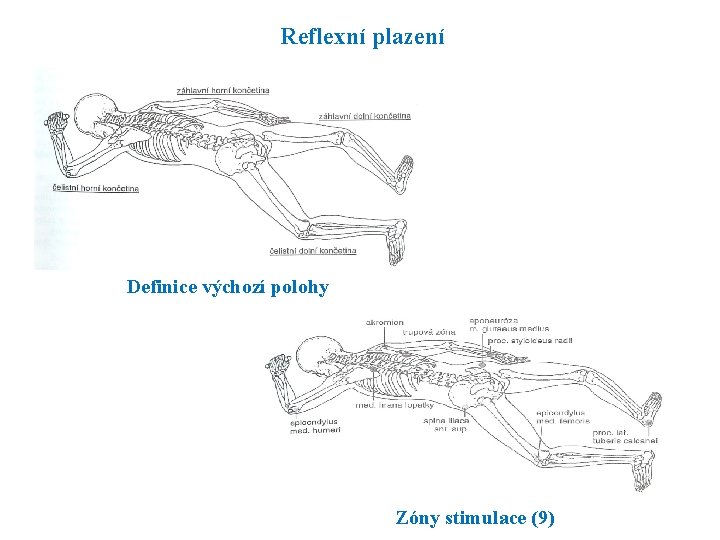 Reflexní plazení Definice výchozí polohy Zóny stimulace (9) 