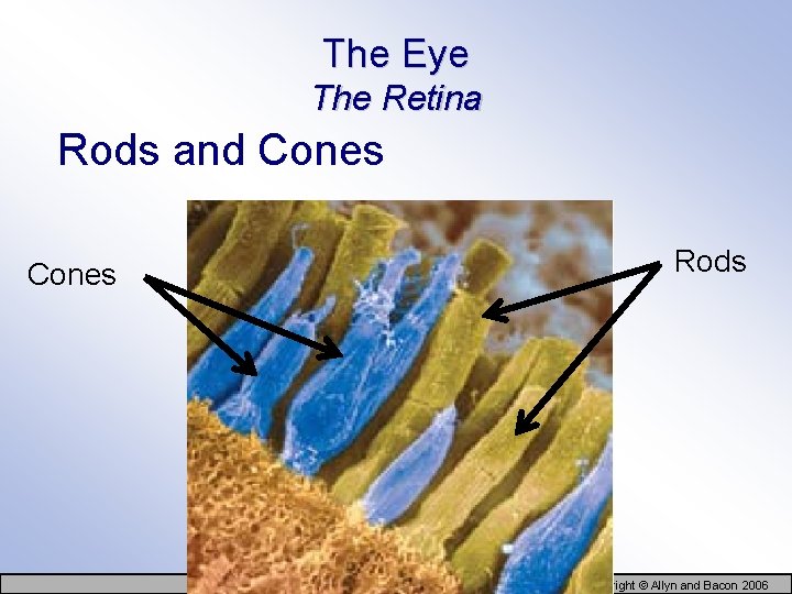 The Eye The Retina Rods and Cones Rods Copyright © Allyn and Bacon 2006