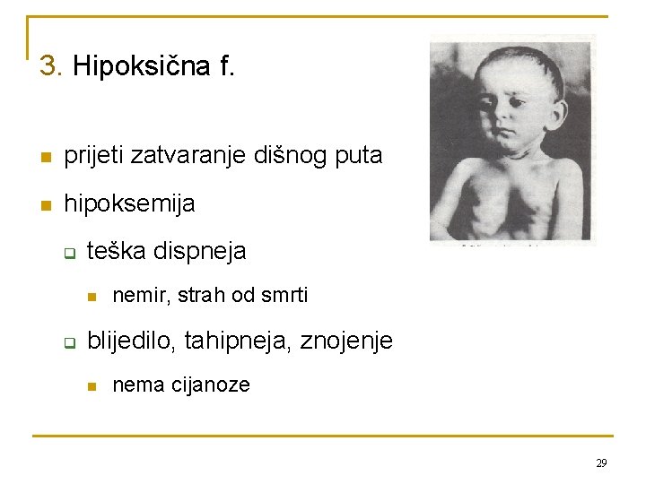 3. Hipoksična f. n prijeti zatvaranje dišnog puta n hipoksemija q teška dispneja n