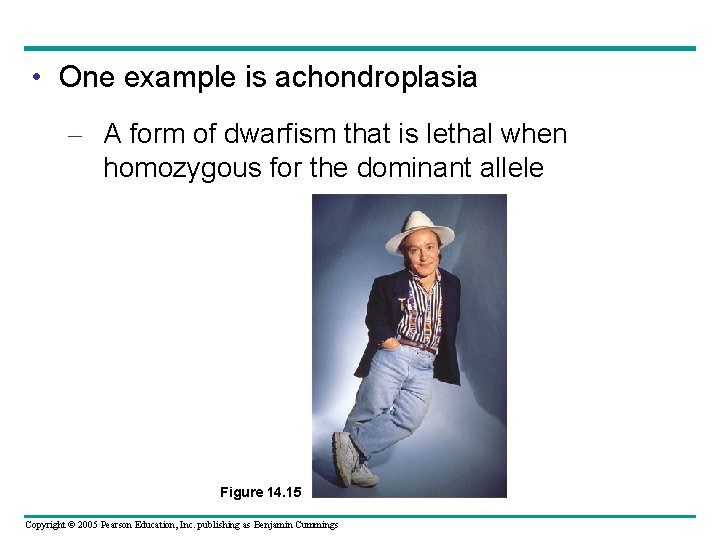  • One example is achondroplasia – A form of dwarfism that is lethal