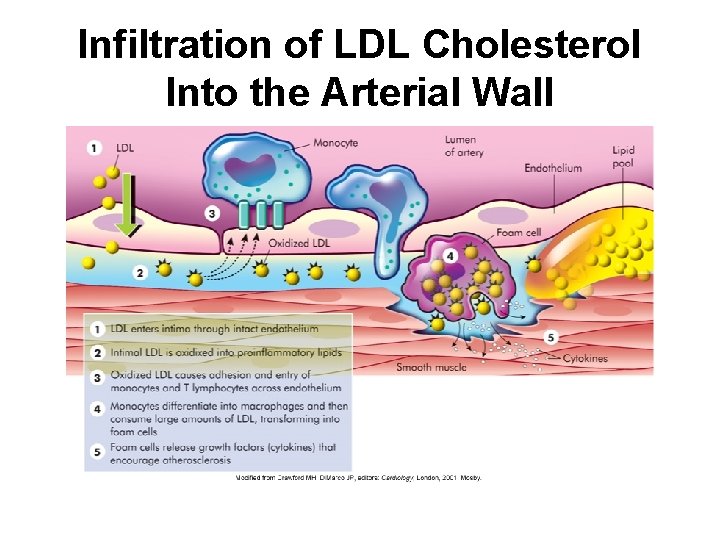 Infiltration of LDL Cholesterol Into the Arterial Wall 