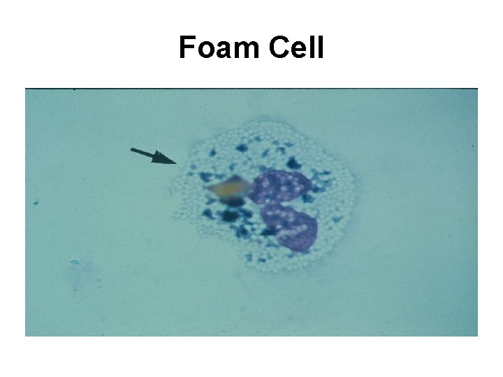 Foam Cell 