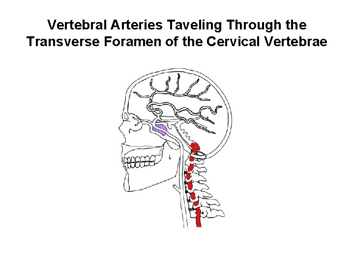 Vertebral Arteries Taveling Through the Transverse Foramen of the Cervical Vertebrae 