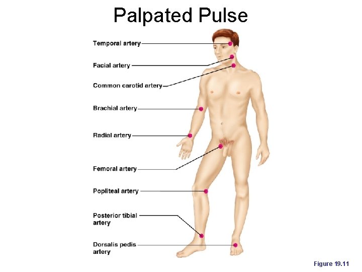 Palpated Pulse Figure 19. 11 