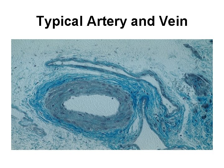 Typical Artery and Vein 