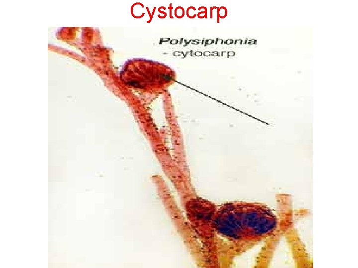 Cystocarp 