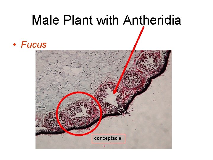 Male Plant with Antheridia • Fucus conceptacle 