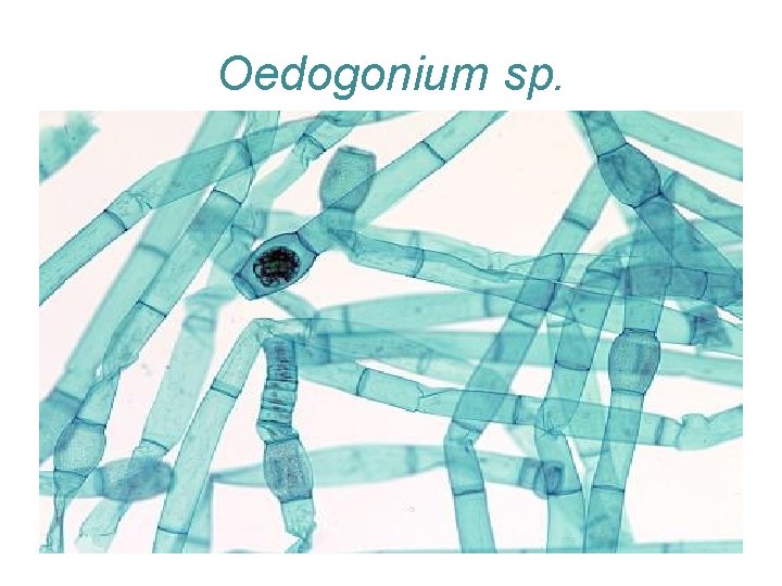 Oedogonium sp. 