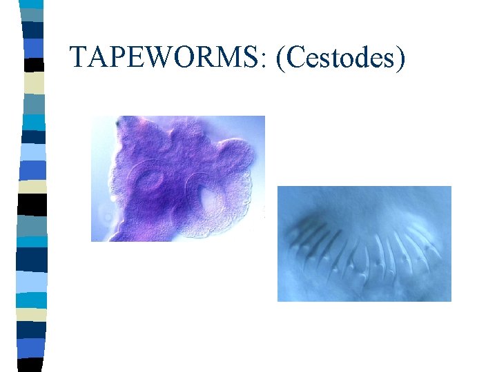 TAPEWORMS: (Cestodes) 