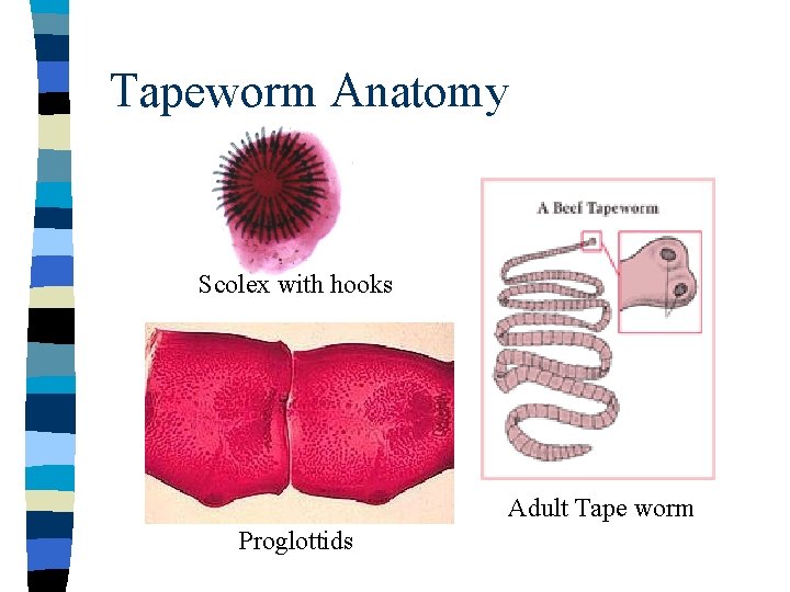 Tapeworm Anatomy Scolex with hooks Adult Tape worm Proglottids 