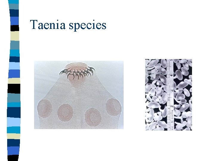 Taenia species 