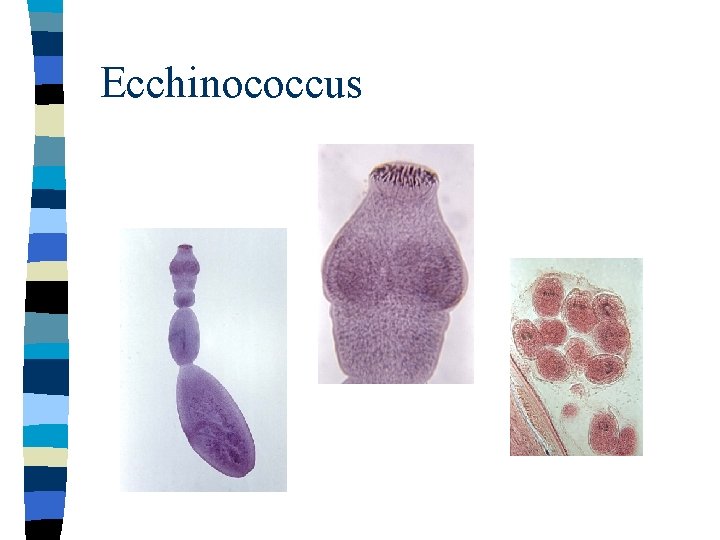Ecchinococcus 
