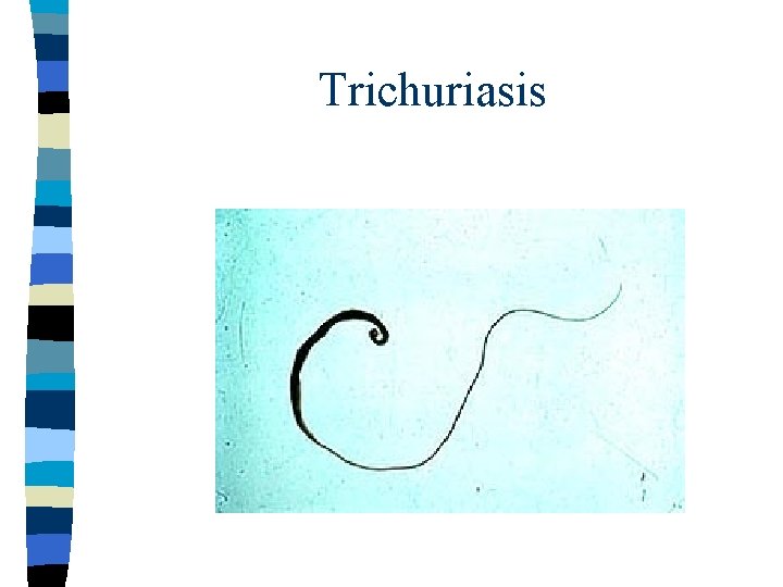Trichuriasis 