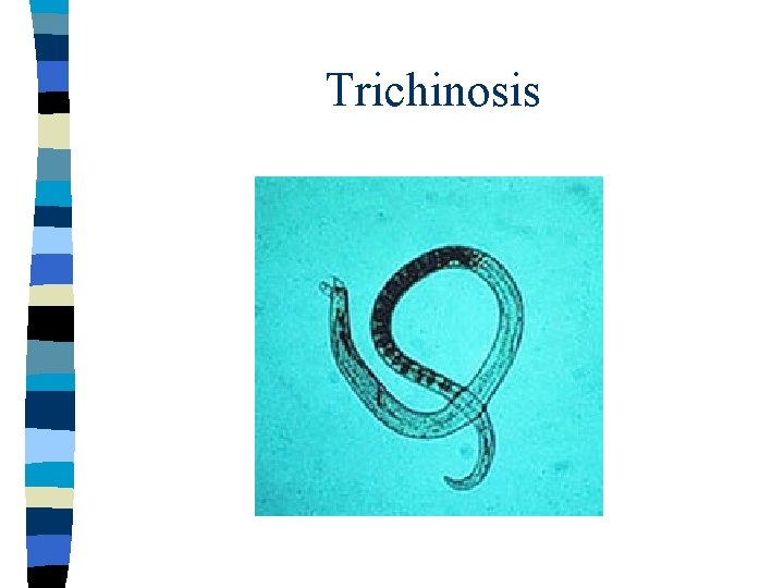 Trichinosis 