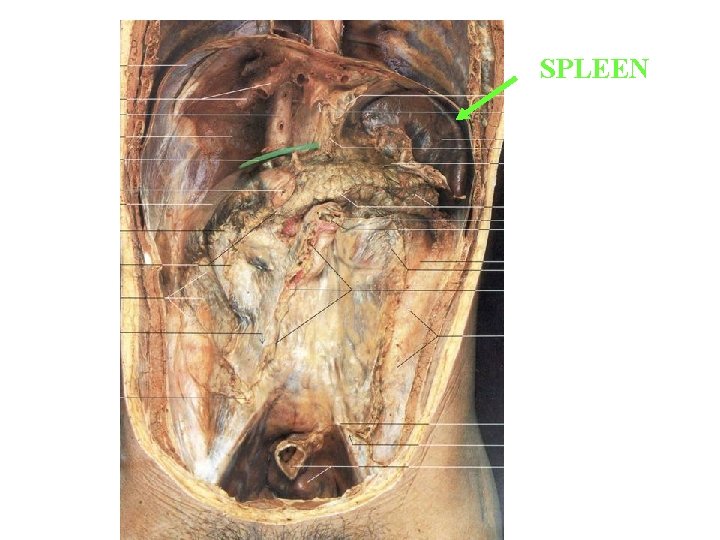 SPLEEN SPLEEN