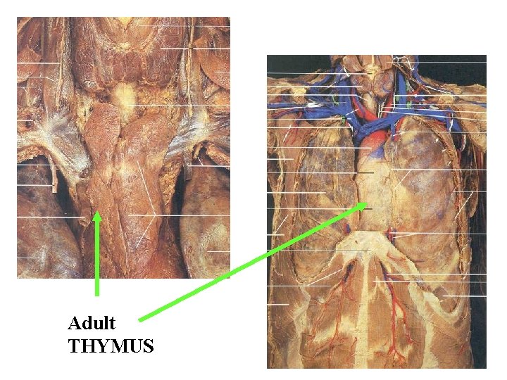 Adult THYMUS Adult THYMUS