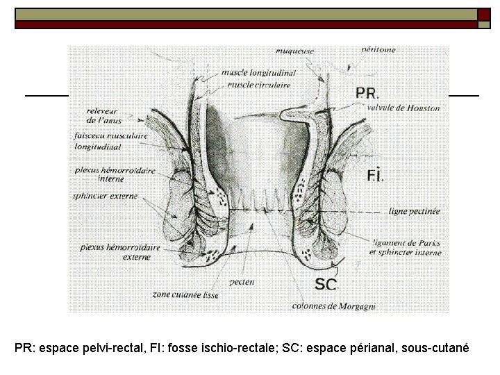PR: espace pelvi-rectal, FI: fosse ischio-rectale; SC: espace périanal, sous-cutané 