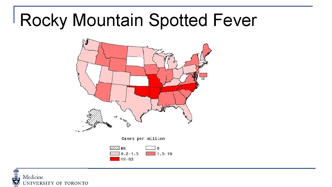 Rocky Mountain Spotted Fever 