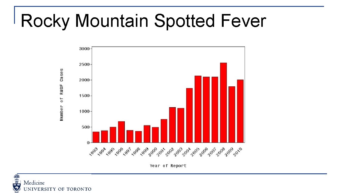 Rocky Mountain Spotted Fever 