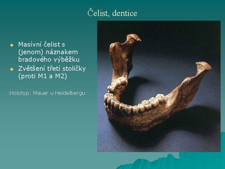 Čelist, dentice u u Masívní čelist s (jenom) náznakem bradového výběžku Zvětšení třetí stoličky