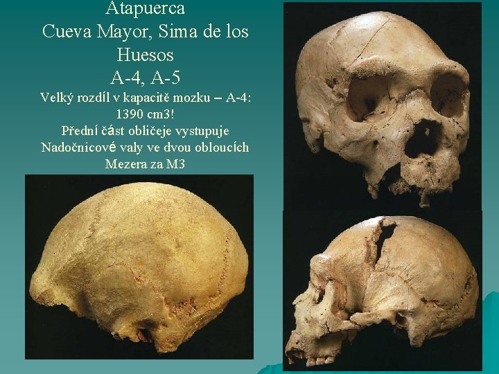 Atapuerca Cueva Mayor, Sima de los Huesos A-4, A-5 Velký rozdíl v kapacitě mozku