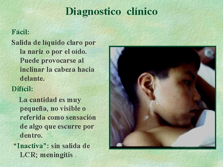 Diagnostico clínico Fácil: Salida de líquido claro por la nariz o por el oído.