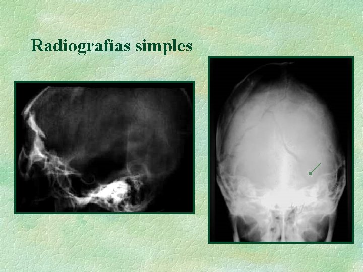 Radiografías simples 