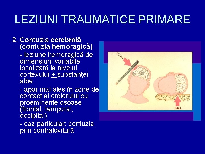 LEZIUNI TRAUMATICE PRIMARE 2. Contuzia cerebrală (contuzia hemoragică) - leziune hemoragică de dimensiuni variabile