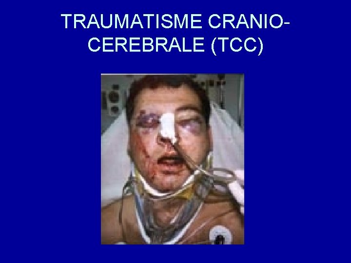 TRAUMATISME CRANIOCEREBRALE (TCC) 