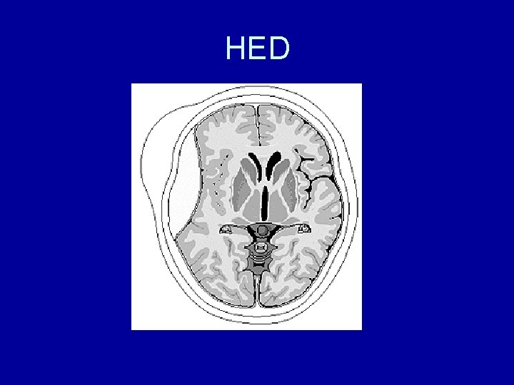 HED 