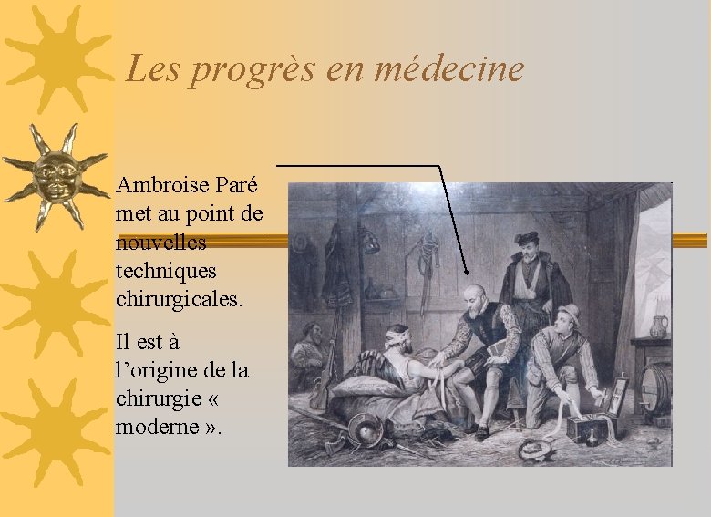 Les progrès en médecine Ambroise Paré met au point de nouvelles techniques chirurgicales. Il