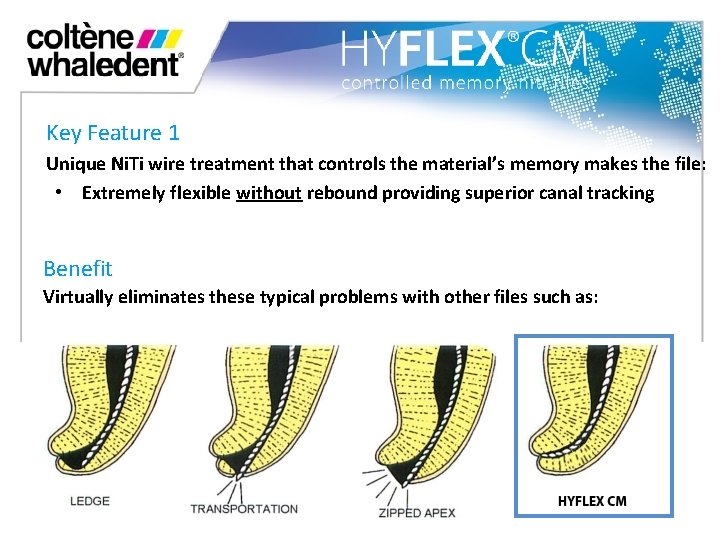 Key Feature 1 Unique Ni. Ti wire treatment that controls the material’s memory makes