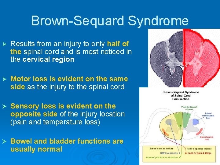 Brown-Sequard Syndrome Ø Results from an injury to only half of the spinal cord