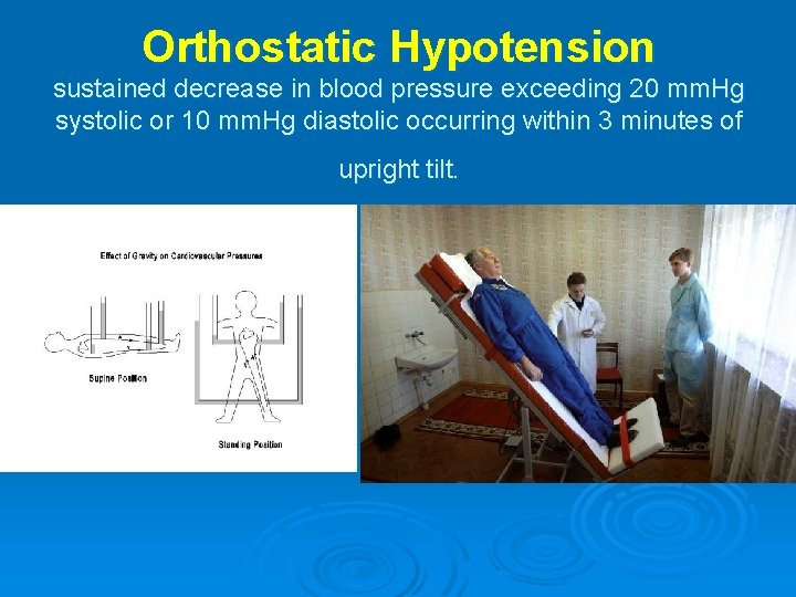 Orthostatic Hypotension sustained decrease in blood pressure exceeding 20 mm. Hg systolic or 10