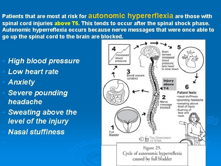 Patients that are most at risk for autonomic hypererflexia are those with spinal cord Patients that are most at risk for autonomic hypererflexia are those with spinal cord