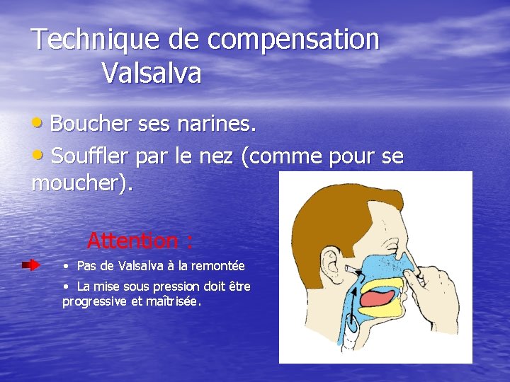 Technique de compensation Valsalva • Boucher ses narines. • Souffler par le nez (comme