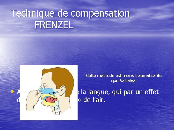 Technique de compensation FRENZEL Cette méthode est moins traumatisante que Valsalva. • Action musculaire