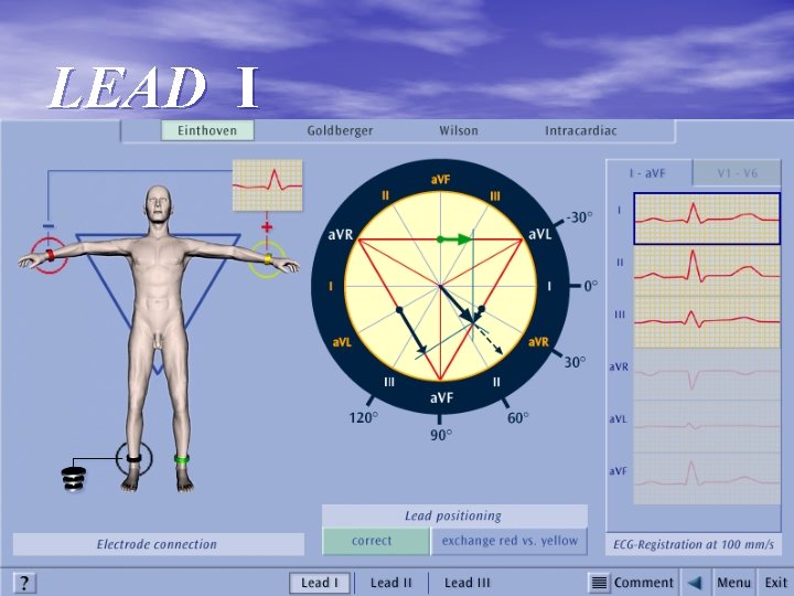 LEAD I 