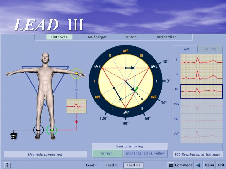 LEAD III 