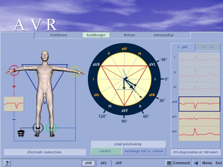 AVR 