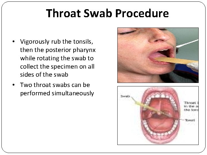 Throat Swab Procedure • Vigorously rub the tonsils, then the posterior pharynx while rotating