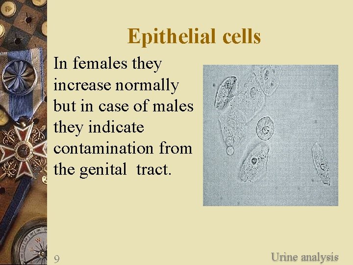 Epithelial cells In females they increase normally but in case of males they indicate