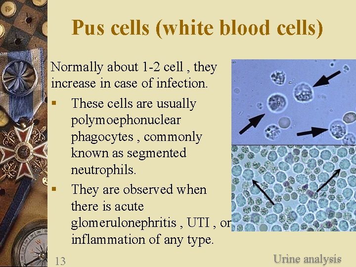 Pus cells (white blood cells) Normally about 1 -2 cell , they increase in