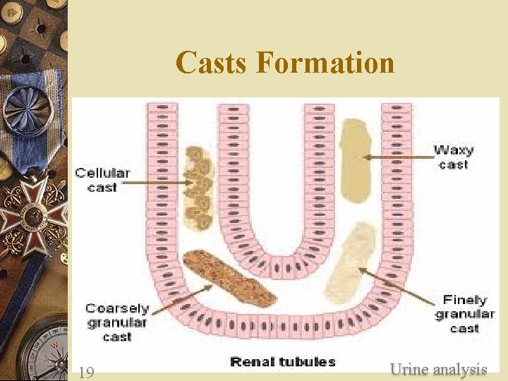 Casts Formation 19 Urine analysis 