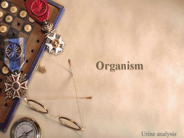 Organism 28 Urine analysis 