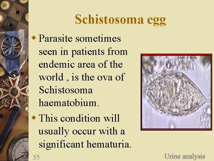 Schistosoma egg w Parasite sometimes seen in patients from endemic area of the world Schistosoma egg w Parasite sometimes seen in patients from endemic area of the world